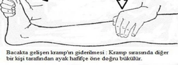 Kramp Girince Ne Yapılır?